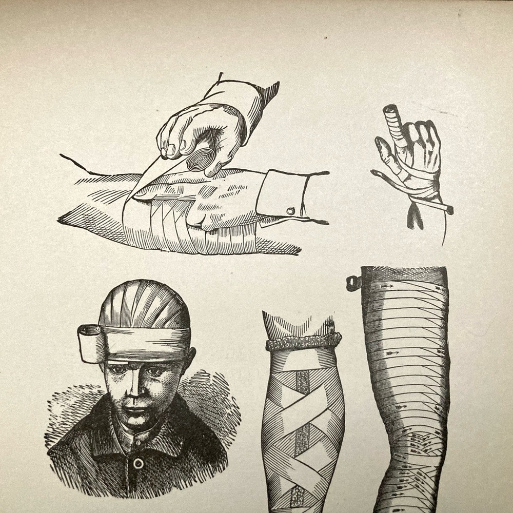 Vintage Medical Diagram | Bandages | Circa 1903